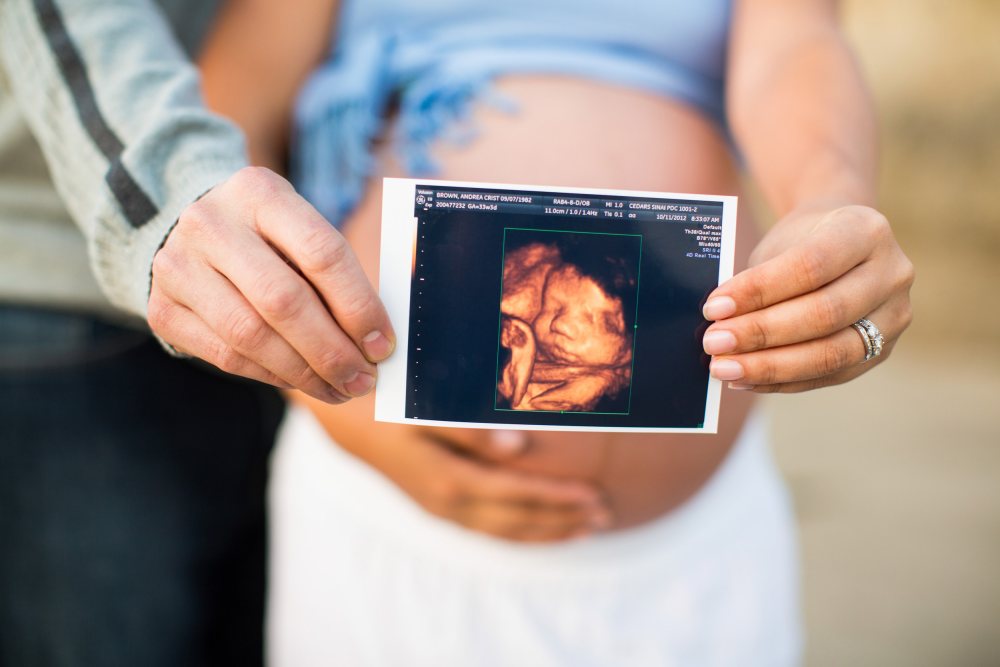 Maternity-and-Newborn-Portraits 22